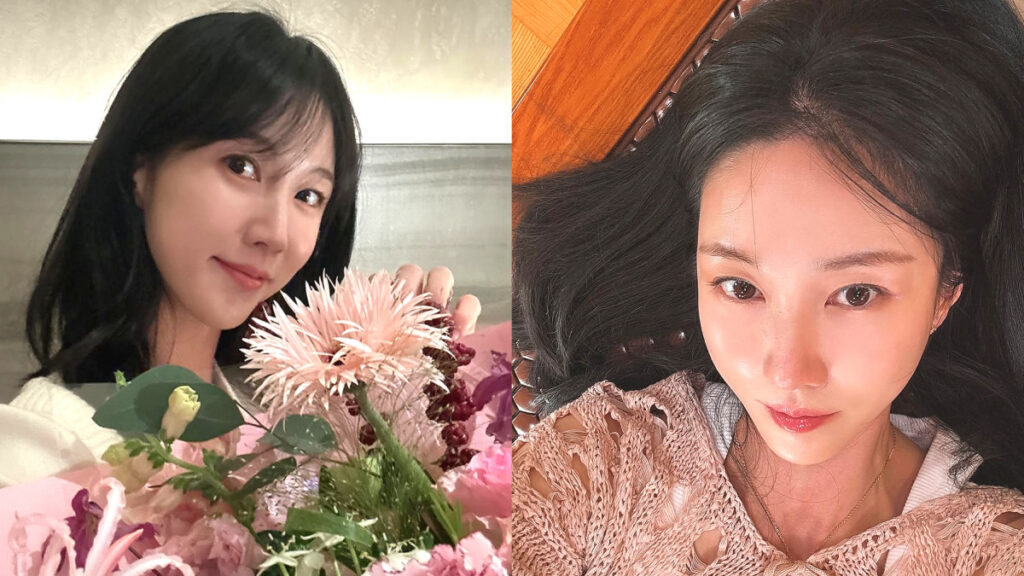 actress-lee-su-kyung-5-year-hiatus-business-failure-skin-disease (1)